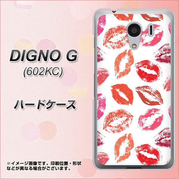 SoftBank ディグノG 602KC 高画質仕上げ 背面印刷 ハードケース【734 キスkissキス】