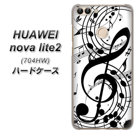 SoftBank HUAWEI nova lite 2 704HW 高画質仕上げ 背面印刷 ハードケース【260 あふれる音符】