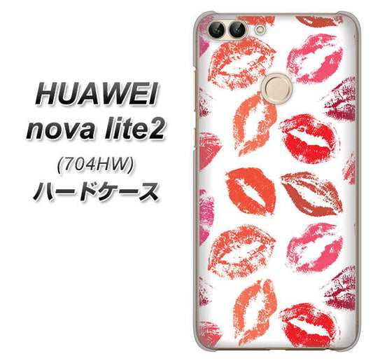 SoftBank HUAWEI nova lite 2 704HW 高画質仕上げ 背面印刷 ハードケース【734 キスkissキス】
