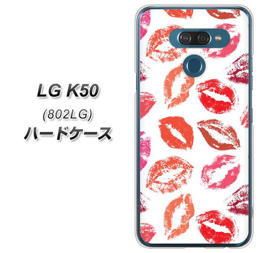 softbank LG K50 802LG 高画質仕上げ 背面印刷 ハードケース【734 キスkissキス】