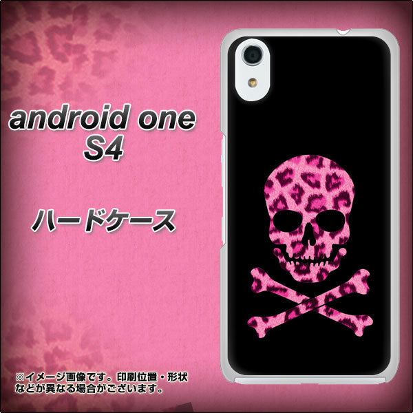 Android One S4 高画質仕上げ 背面印刷 ハードケース【1079 ドクロフレームヒョウピンク】