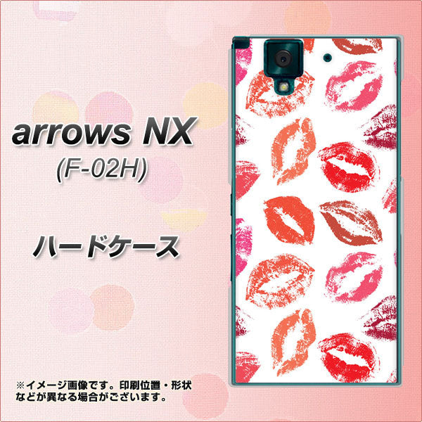docomo アローズNX F-02H 高画質仕上げ 背面印刷 ハードケース【734 キスkissキス】