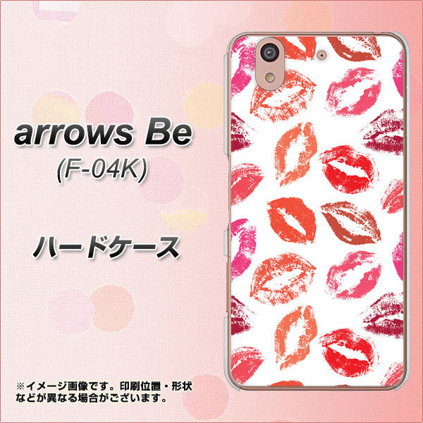 docomo アローズ ビー F-04K 高画質仕上げ 背面印刷 ハードケース【734 キスkissキス】