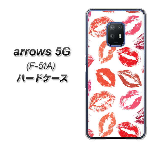 docomo アローズ5G F-51A 高画質仕上げ 背面印刷 ハードケース【734 キスkissキス】