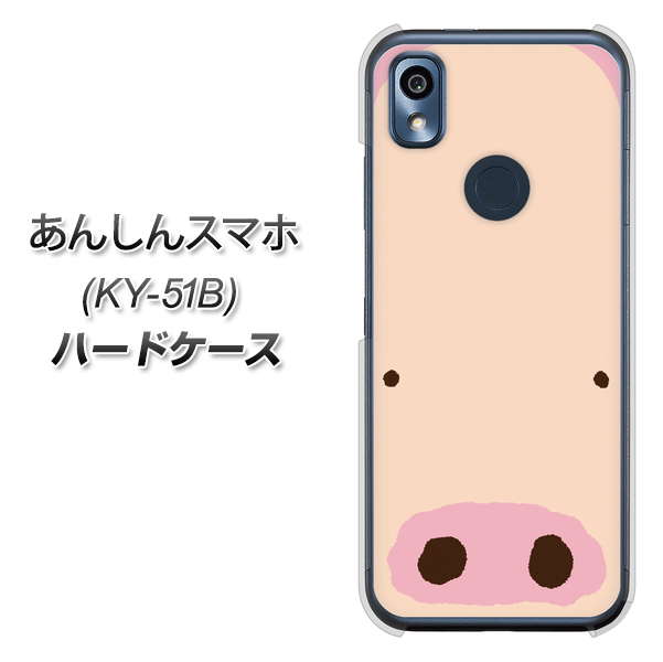 あんしんスマホ KY-51B docomo 高画質仕上げ 背面印刷 ハードケース【353 ぶた】