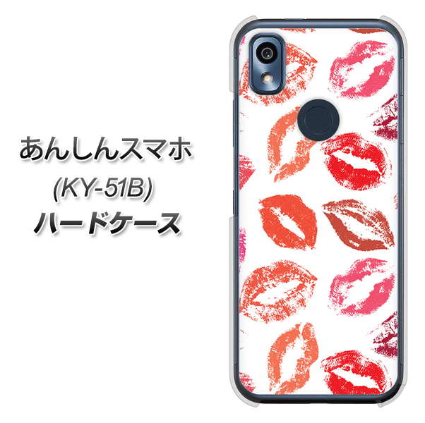 あんしんスマホ KY-51B docomo 高画質仕上げ 背面印刷 ハードケース【734 キスkissキス】