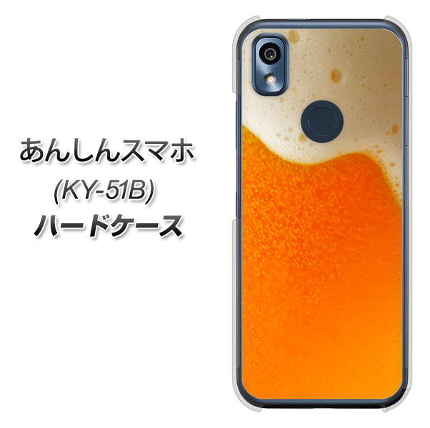 あんしんスマホ KY-51B docomo 高画質仕上げ 背面印刷 ハードケース【VA855 ジョッキ生(ビール)】