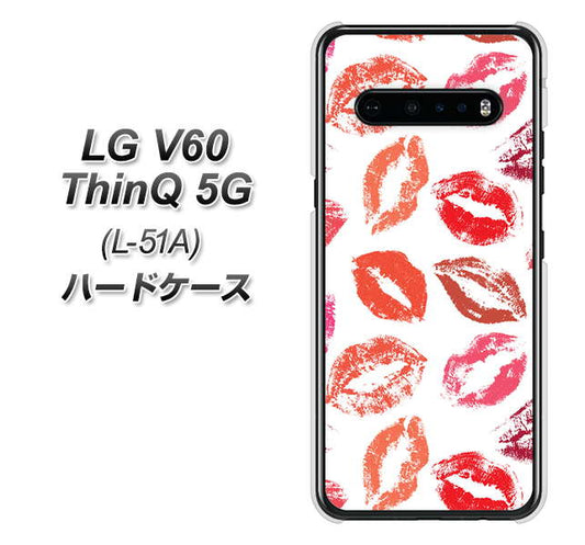 docomo LG V60 ThinQ 5G L-51A 高画質仕上げ 背面印刷 ハードケース【734 キスkissキス】