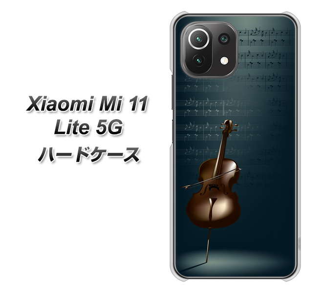 Xiaomi(シャオミ)Mi 11 Lite 5G 高画質仕上げ 背面印刷 ハードケース【441 楽譜】