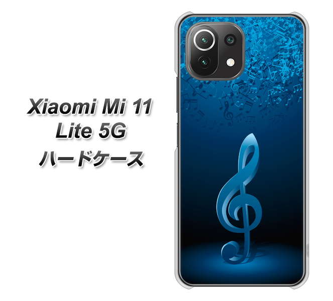 Xiaomi(シャオミ)Mi 11 Lite 5G 高画質仕上げ 背面印刷 ハードケース【588 オーケストラ】