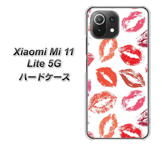 Xiaomi(シャオミ)Mi 11 Lite 5G 高画質仕上げ 背面印刷 ハードケース【734 キスkissキス】