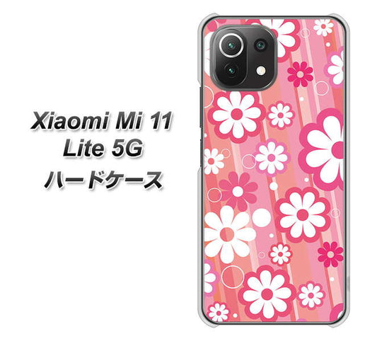 Xiaomi（シャオミ）Mi 11 Lite 5G 高画質仕上げ 背面印刷 ハードケース【751 マーガレット（ピンク系）】
