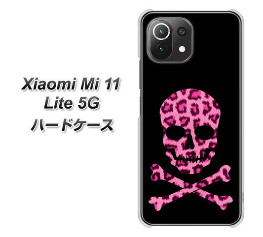 Xiaomi(シャオミ)Mi 11 Lite 5G 高画質仕上げ 背面印刷 ハードケース【1079 ドクロフレームヒョウピンク】