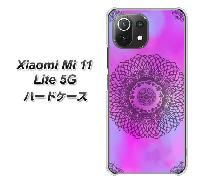 Xiaomi(シャオミ)Mi 11 Lite 5G 高画質仕上げ 背面印刷 ハードケース【YJ344 レース】