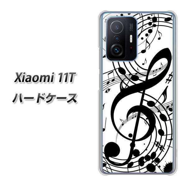 Xiaomi 11T 高画質仕上げ 背面印刷 ハードケース【260 あふれる音符】