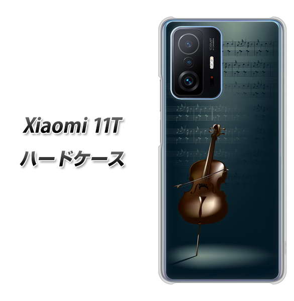 Xiaomi 11T 高画質仕上げ 背面印刷 ハードケース【441 楽譜】