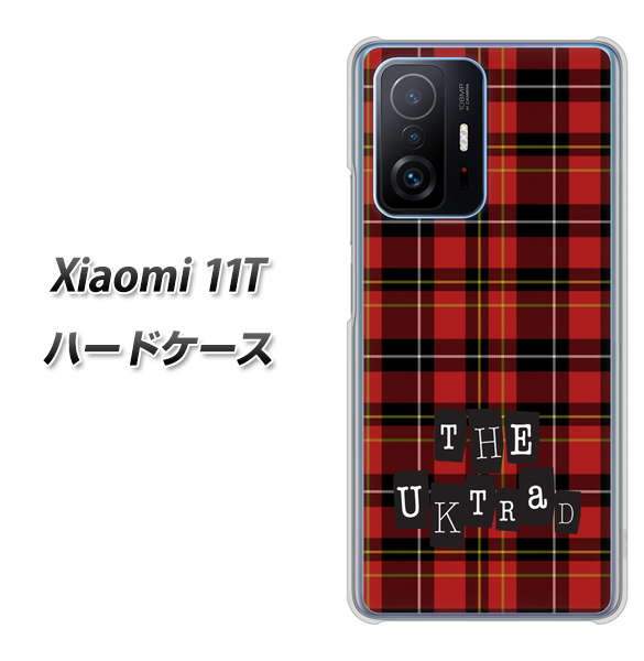 Xiaomi 11T 高画質仕上げ 背面印刷 ハードケース【547 THEチェック】