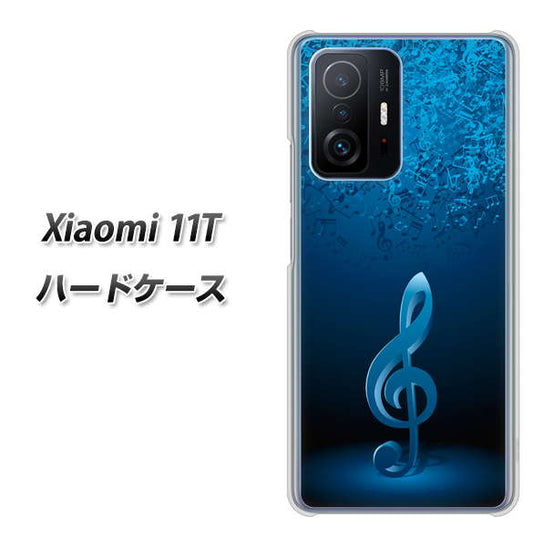 Xiaomi 11T 高画質仕上げ 背面印刷 ハードケース【588 オーケストラ】