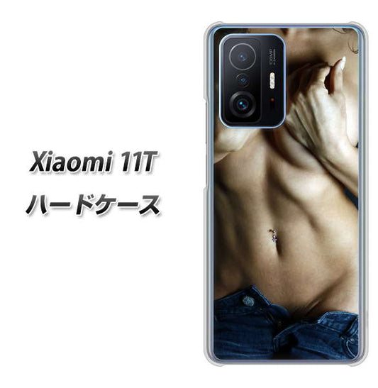 Xiaomi 11T 高画質仕上げ 背面印刷 ハードケース【602 ボディライン】