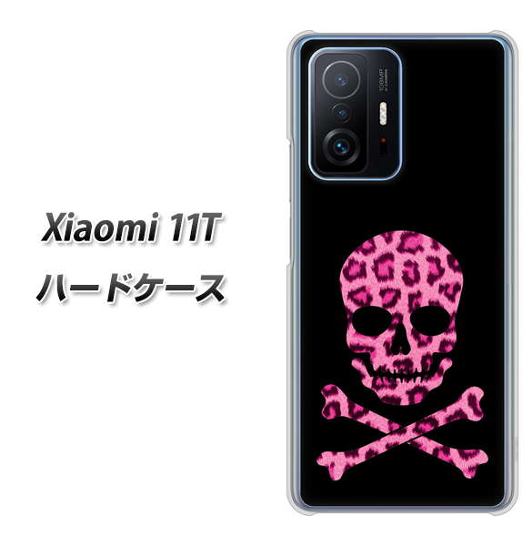 Xiaomi 11T 高画質仕上げ 背面印刷 ハードケース【1079 ドクロフレームヒョウピンク】