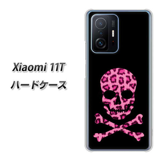 Xiaomi 11T 1079 ドクロフレームヒョウピンク ハードケース 背面印刷