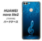 SoftBank HUAWEI nova lite 2 704HW 高画質仕上げ 背面印刷 ハードケース【588 オーケストラ】