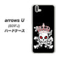 softbank arrows U 801FJ 高画質仕上げ 背面印刷 ハードケース【AG801 苺骸骨王冠（黒）】