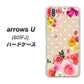 softbank arrows U 801FJ 高画質仕上げ 背面印刷 ハードケース【SC825 ロリータレース】