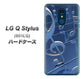 Y!mobile LG Q Stylus 801LG 高画質仕上げ 背面印刷 ハードケース【286 3D 音符】