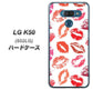 softbank LG K50 802LG 高画質仕上げ 背面印刷 ハードケース【734 キスkissキス】