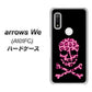 arrows We A101FC 高画質仕上げ 背面印刷 ハードケース【1079 ドクロフレームヒョウピンク】