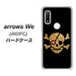 arrows We A101FC 高画質仕上げ 背面印刷 ハードケース【1082 海賊ドクロ】