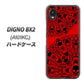 DIGNO BX2 A101KC SoftBank 高画質仕上げ 背面印刷 ハードケース【AG835 苺骸骨曼荼羅（赤）】