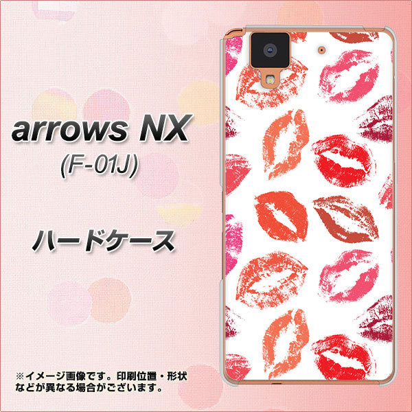docomo アローズ NX F-01J 高画質仕上げ 背面印刷 ハードケース【734 キスkissキス】