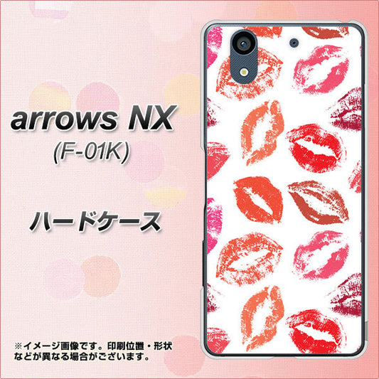 docomo アローズ NX F-01K 高画質仕上げ 背面印刷 ハードケース【734 キスkissキス】