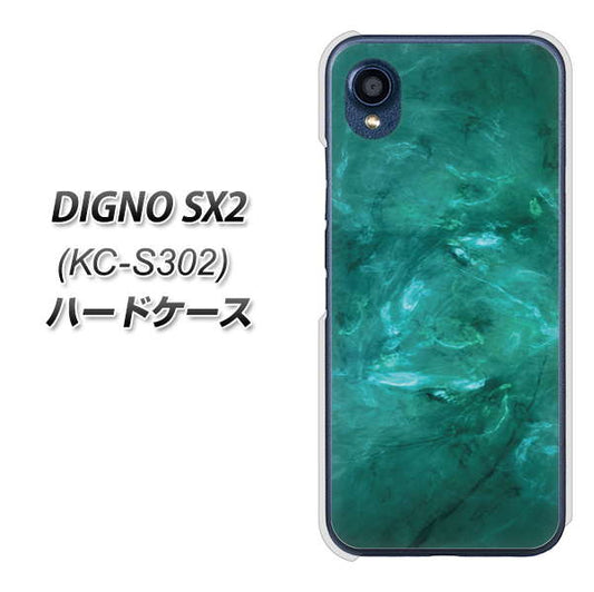 DIGNO SX2 KC-S302 高画質仕上げ 背面印刷 ハードケース【KM869 大理石GR】