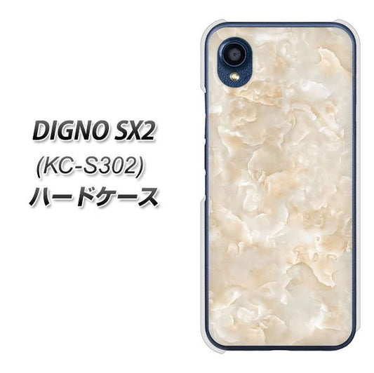 DIGNO SX2 KC-S302 高画質仕上げ 背面印刷 ハードケース【KM872 大理石パール】