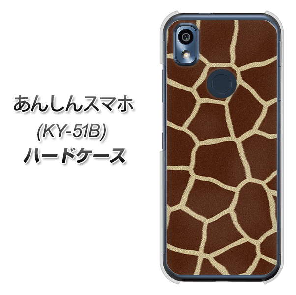 あんしんスマホ KY-51B docomo 高画質仕上げ 背面印刷 ハードケース【209 キリンの背中】