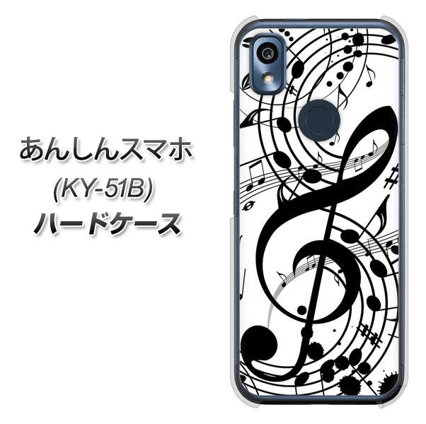 あんしんスマホ KY-51B docomo 高画質仕上げ 背面印刷 ハードケース【260 あふれる音符】