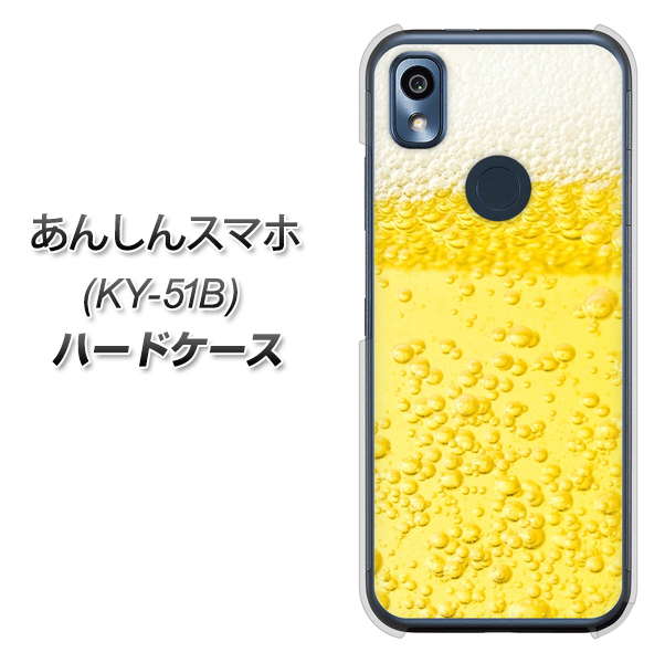 あんしんスマホ KY-51B docomo 高画質仕上げ 背面印刷 ハードケース【450 生ビール】