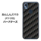 あんしんスマホ KY-51B docomo 高画質仕上げ 背面印刷 ハードケース【461 カーボン】