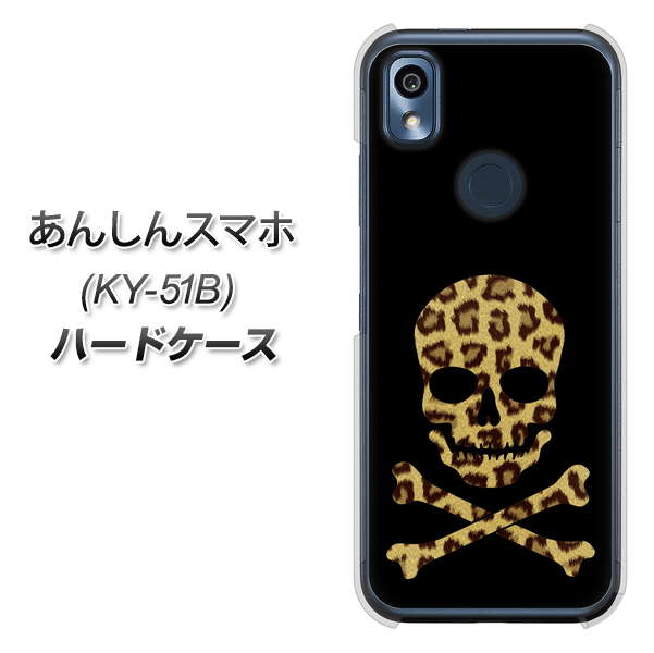 あんしんスマホ KY-51B docomo 高画質仕上げ 背面印刷 ハードケース【1078 ドクロフレームヒョウその他のカラー】