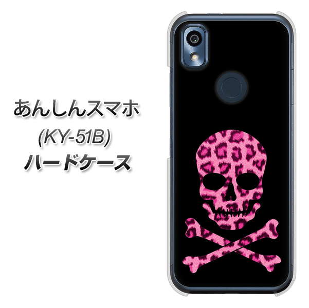 あんしんスマホ KY-51B docomo 高画質仕上げ 背面印刷 ハードケース【1079 ドクロフレームヒョウピンク】