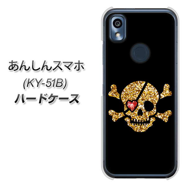 あんしんスマホ KY-51B docomo 高画質仕上げ 背面印刷 ハードケース【1082 海賊ドクロ】