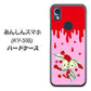 あんしんスマホ KY-51B docomo 高画質仕上げ 背面印刷 ハードケース【AG813 ジッパーうさぎのジッピョン（ピンク×赤）】