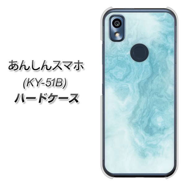 あんしんスマホ KY-51B docomo 高画質仕上げ 背面印刷 ハードケース【KM868 大理石BL】