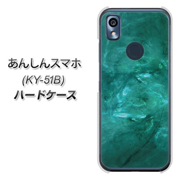 あんしんスマホ KY-51B docomo 高画質仕上げ 背面印刷 ハードケース【KM869 大理石GR】