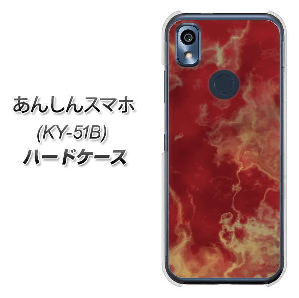 あんしんスマホ KY-51B docomo 高画質仕上げ 背面印刷 ハードケース【KM870 大理石RD】