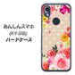あんしんスマホ KY-51B docomo 高画質仕上げ 背面印刷 ハードケース【SC825 ロリータレース】