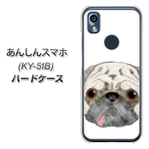 あんしんスマホ KY-51B docomo 高画質仕上げ 背面印刷 ハードケース【YD855 パグ01】